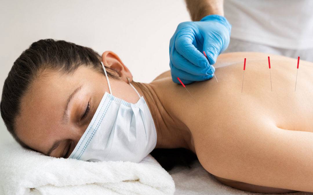 Dry Needling